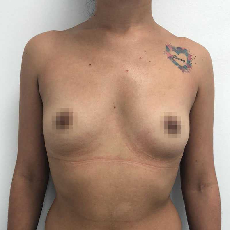 Before image